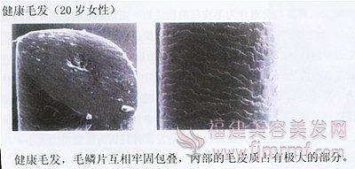 健康毛发的毛鳞片-毛(máo)发构(gòu)造 健康(kāng)毛发(fā)的毛鳞片-毛发构造(zào)